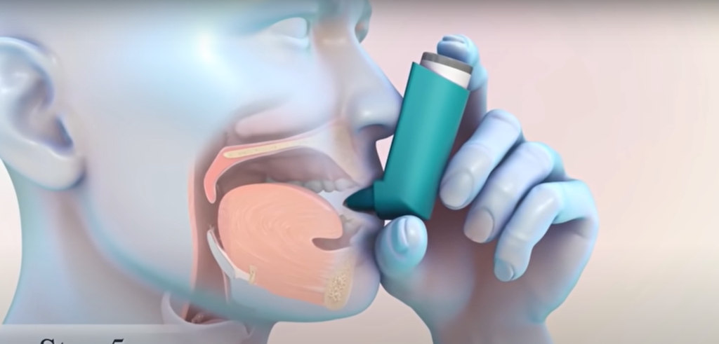 metered dose inhaler