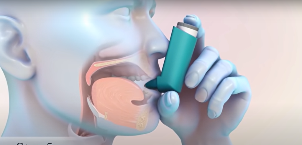 metered dose inhaler 